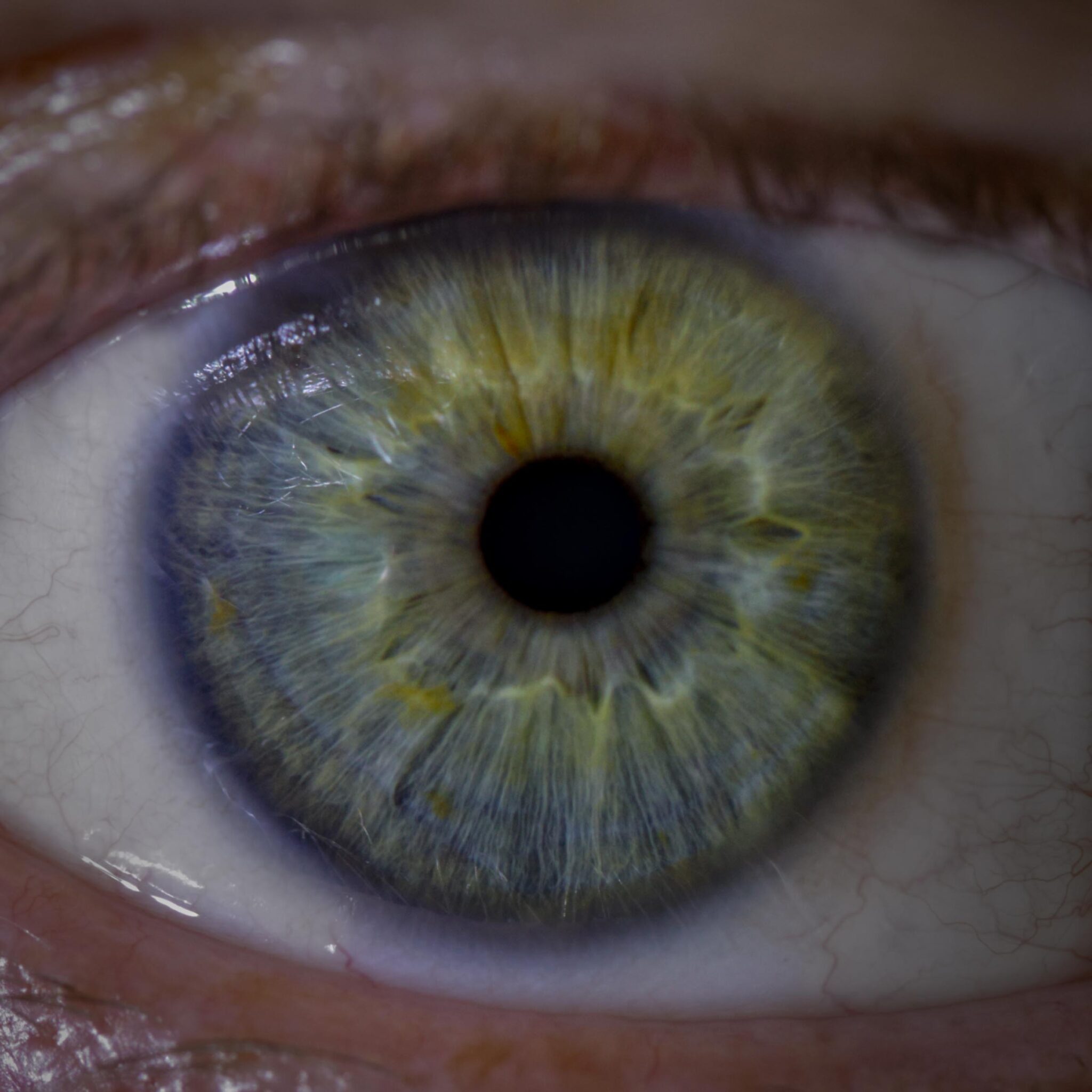 Eye